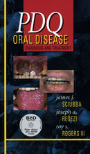 PDQ Oral Disease: Diagnosis and Treatment