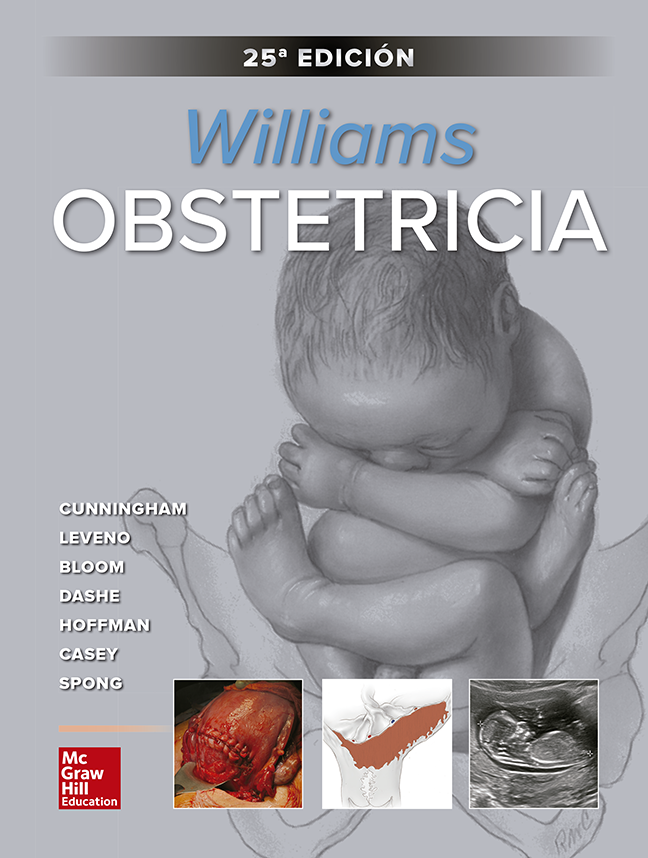 VS OBSTETRICIA DE WILLIAMS